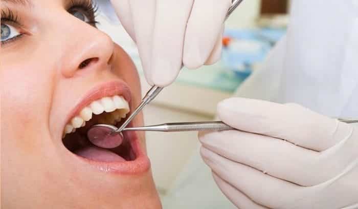 dental cyst